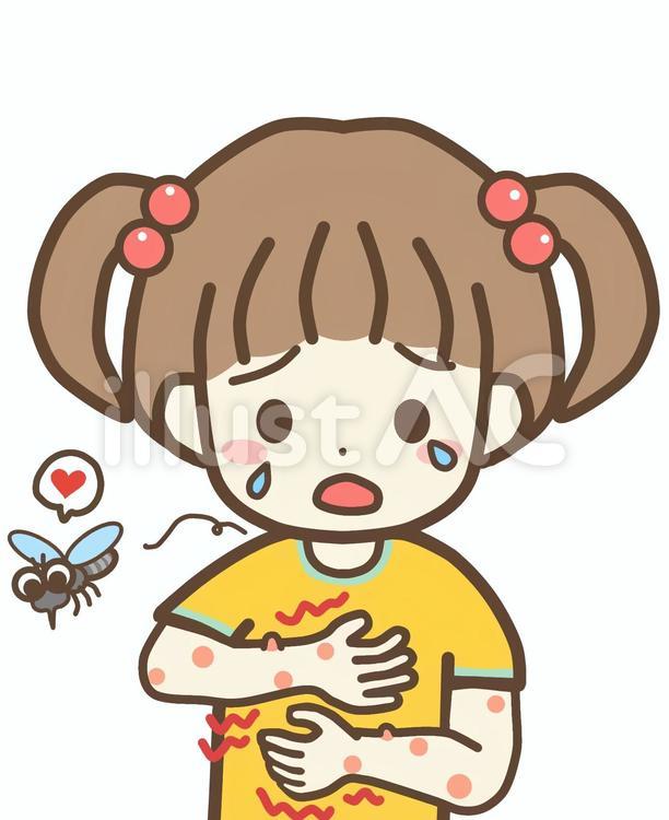 蚊に刺されてかゆくて涙目の女の子 蚊,刺される,かゆいのイラスト素材