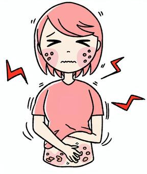 桃色の女の子　蕁麻疹 ピンク,手描き,蕁麻疹,じんましん,かゆみ,肌トラブル,皮膚トラブル,アレルギー,アレルギー症状,皮膚疾患のイラスト素材