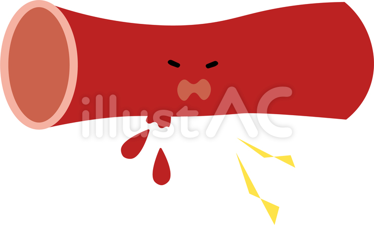 顔つき　血管 顔つき,血管,動脈のイラスト素材