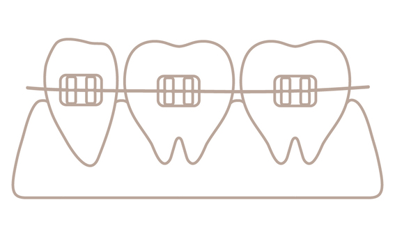 Bracket correction (line drawing), tooth, remediation, orthodontics, JPG, PNG and AI