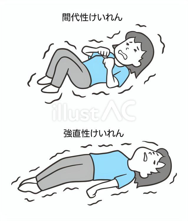 間代性痙攣と強直性痙攣、女性2 間代性痙攣,強直性痙攣,てんかんのイラスト素材