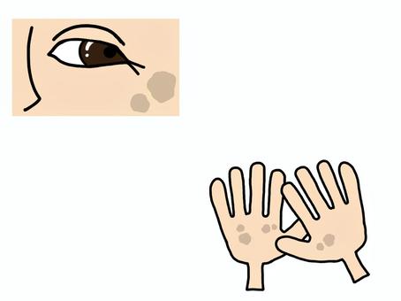 skin blemish, skin blemish, symi, people, eye,