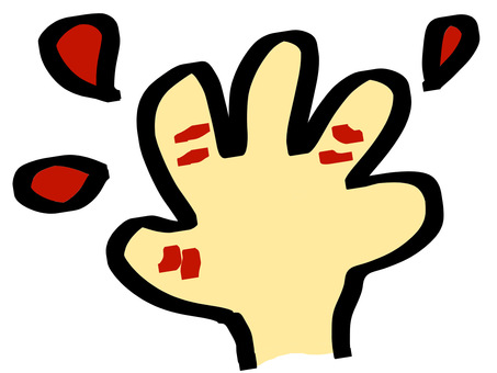 アカギレ、しもやけ しもやけ,手,冬,けが,血,手書きのイラスト素材