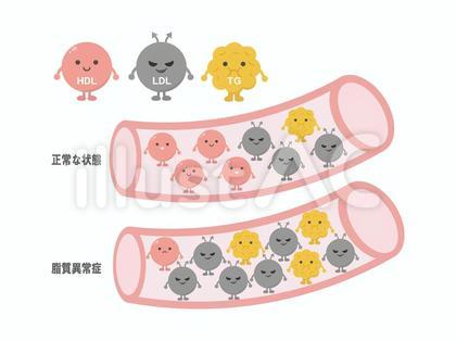 脂質異常症2