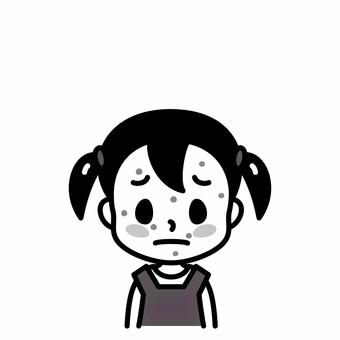 女の子　発疹　白黒 発疹,子供,白黒,湿疹,水疱瘡,病気,症状,皮膚疾患,アレルギー,麻疹のイラスト素材
