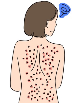 背中にぶつぶつ　女性カラー 背中,肌荒れ,トラブル,皮膚,異常,女性,カラーのイラスト素材