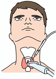 甲状腺にエコーしながら針を刺す　カラー 甲状腺,エコー,針,男性,カラーのイラスト素材