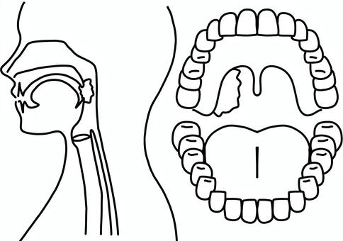 中咽頭癌のある人2つの角度　線画 中咽頭,耳鼻咽喉科,腫瘍,ガン,線画のイラスト素材