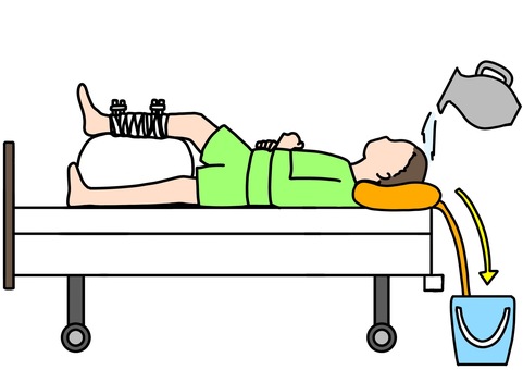 創外固定中の患者のベッド上洗髪 カラー 創外固定中の患者のベッド上洗髪 カラー 創外固定,患者,洗髪,ベッド,整形外科,安静,カラーのイラスト素材