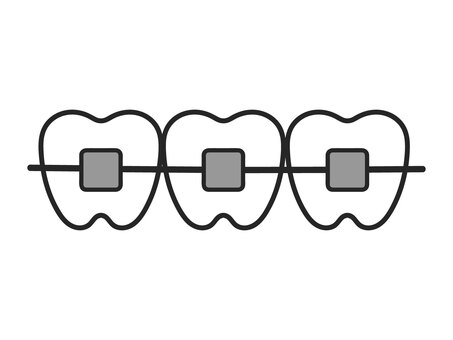 手描きの歯列矯正のイラスト 歯,歯列矯正,矯正,歯科,歯医者,歯並び,おたより,素材,手描き,イラストのイラスト素材