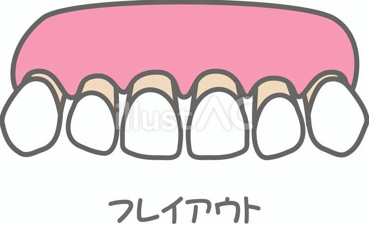 フレイアウト 歯,前歯,歯科のイラスト素材