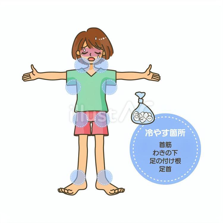 熱中症で冷やすべき箇所イラスト - No: 26607111｜無料イラスト・フリー素材なら「イラストAC」