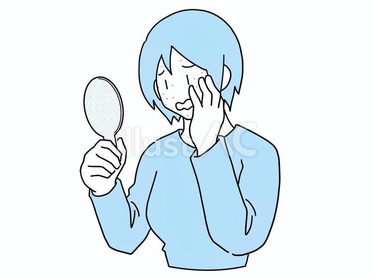 顔に湿疹ができた女性 女性,湿疹,顔のイラスト素材