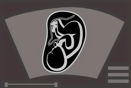 胎児エコー　 胎児,エコー,映像,産婦人科,診察,赤ちゃん,授かる,生命,イメージのイラスト素材