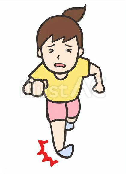 走って足関節を捻挫した女性