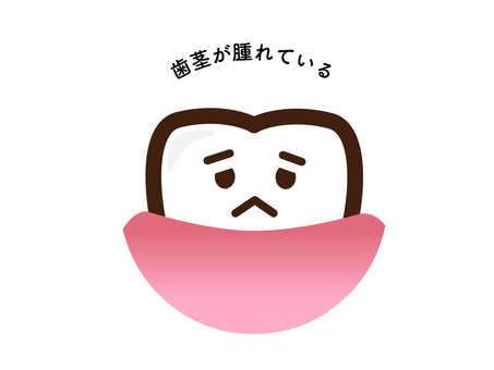 부은 잇몸, JPG, PNG 및 AI 부은 잇몸, 치아, 잇몸, 까다로운, JPG, PNG 및 AI