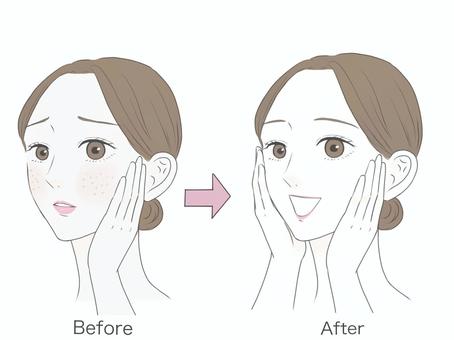 肌荒れに悩む女性 女性,悩む,困る,美人,キレイ,可愛い,悩み,肌荒れ,肌トラブル,肌のイラスト素材