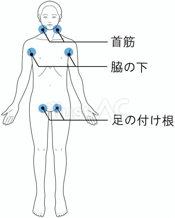 熱中症対策　冷やすポイント文字あり 熱中症,応急処置,緊急処置のイラスト素材