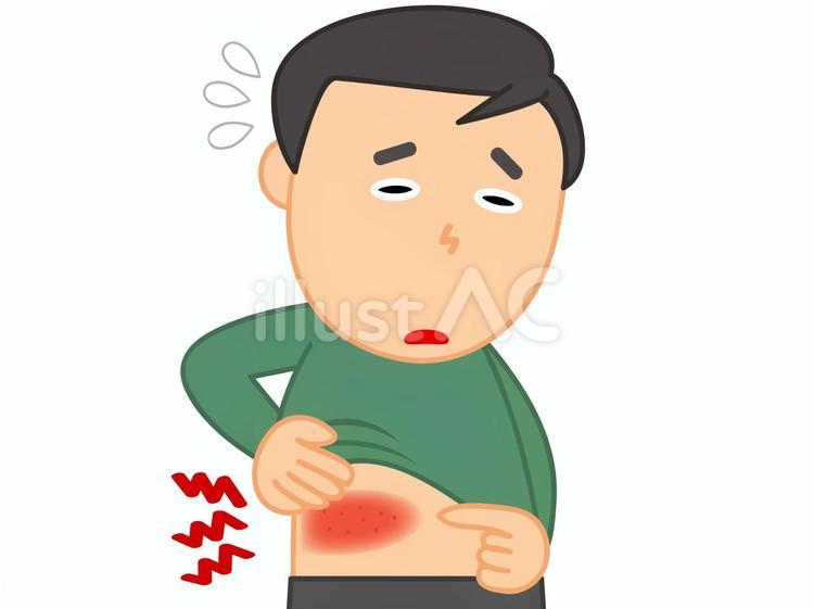 帯状疱疹で痛がる男 帯状疱疹,痛い,かゆいのイラスト素材
