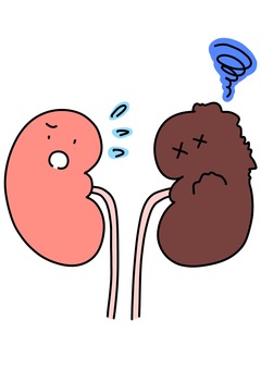 片側の腎臓が不調　カラー 片側,トラブル,不調,腎臓,カラーのイラスト素材