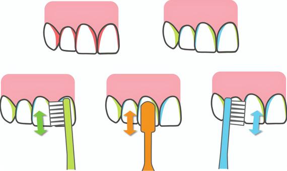 一歯ずつの縦みがき法 一歯ずつの縦みがき法 一歯ずつの縦みがき法,歯ブラシ,磨き方,ブラッシング,縦みがき,前歯,3面,1本ずつ,指導,直角のイラスト素材