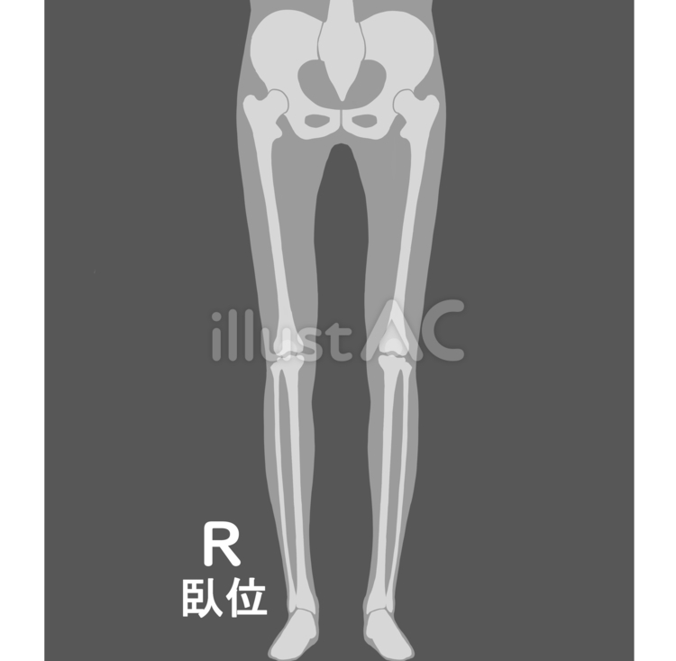 全下肢臥位 医療,レントゲン,撮影のイラスト素材