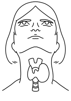 片側甲状腺の腫れた女性　線画 片側,甲状腺,腫脹,腫瘍,女性,線画のイラスト素材