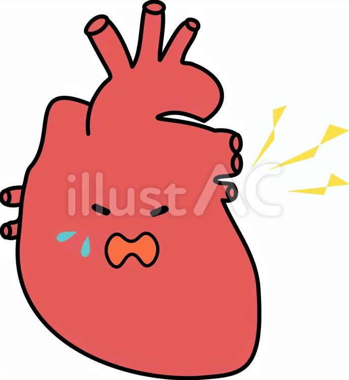 顔つき　心臓　心筋梗塞 顔つき,胸痛,疼痛のイラスト素材