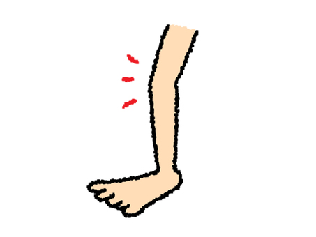 Illustration, knee, leg, pain, 