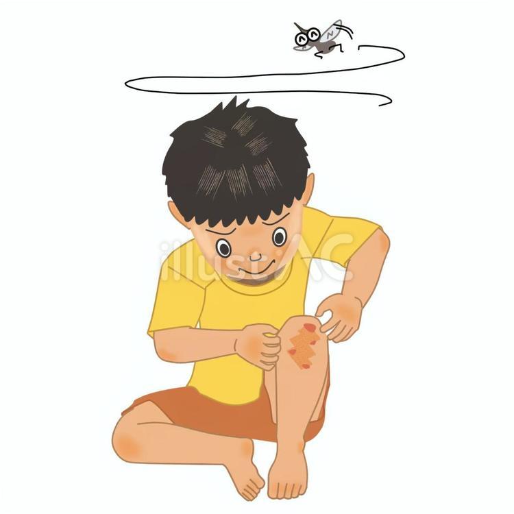 虫に刺されて痒がっている男の子 虫刺され,男の子,蚊のイラスト素材