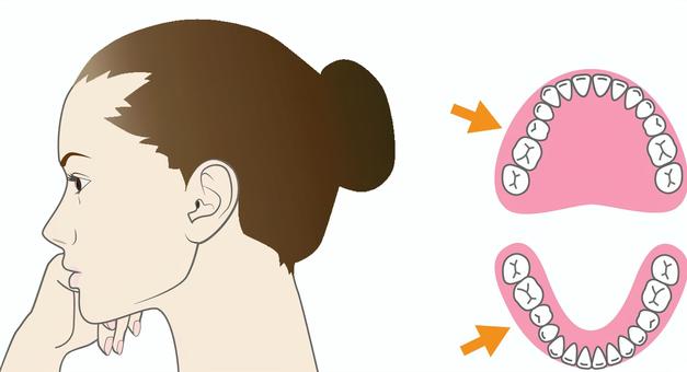 頬杖と歯並び 頬杖,歯科,歯並び,矯正,歯列不正,女性,横顔のイラスト素材