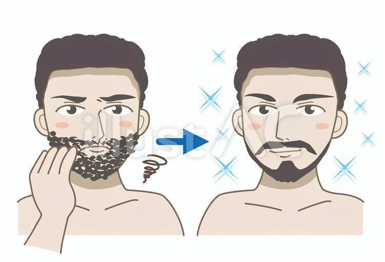 無精ひげ・ビフォーアフターB アゴ髭,男性美容,生えているのイラスト素材