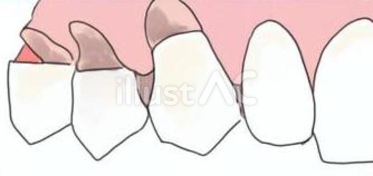 WSD wsd,歯科衛生士,歯医者のイラスト素材