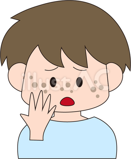 シミ 男性