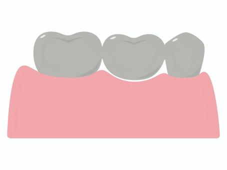 歯科　差し歯（ブリッジ） ブリッジ,差し歯,冠,被せ物,歯,金属,単体,メタル,奥歯,臼歯のイラスト素材