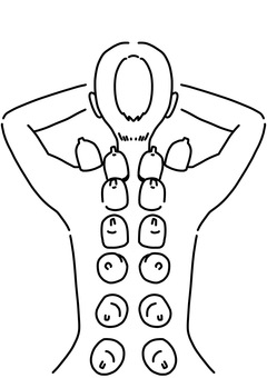 Illustration, cupping, female, back, 