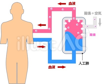 人工肺