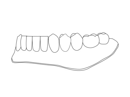 下顎総義歯 斜め45度（主線のみ） フルデンチャー,総義歯,入れ歯,下顎義歯,歯科技工,歯科技工士,歯科,医療,教材用イラスト,vectorのイラスト素材