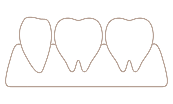 Three side-by-side teeth (line drawing) Three side-by-side teeth (line drawing)