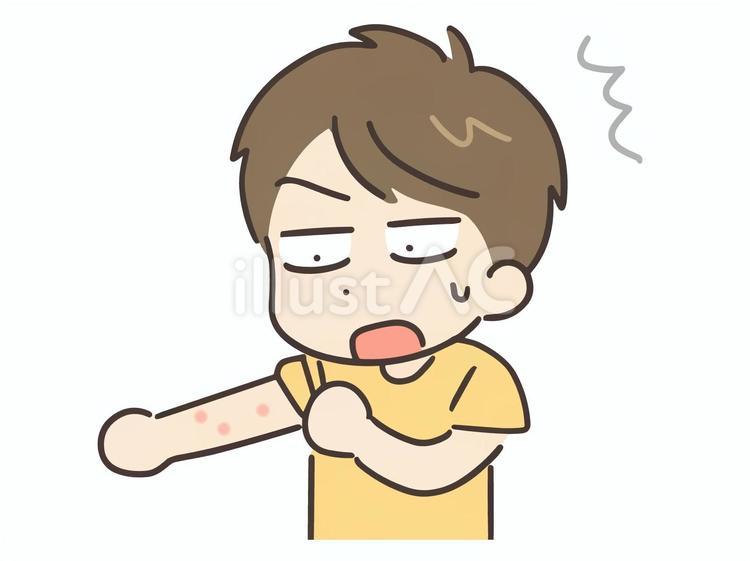 腕に赤いブツブツができている男性 男性,肌,肌荒れのイラスト素材