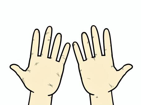 両手3 両手,手,人体,手のひら,手相,広げる,傷のイラスト素材