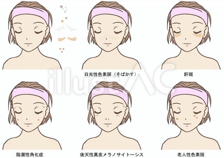 シミ シミ,女性,肌のトラブルのイラスト素材