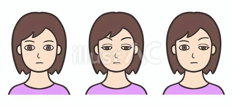 眼瞼下垂、女性の顔 眼瞼下垂,正常,片目のイラスト素材