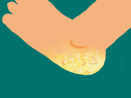 踵のひび割れ 踵,角質,ひび割れ,乾燥,皮膚のイラスト素材