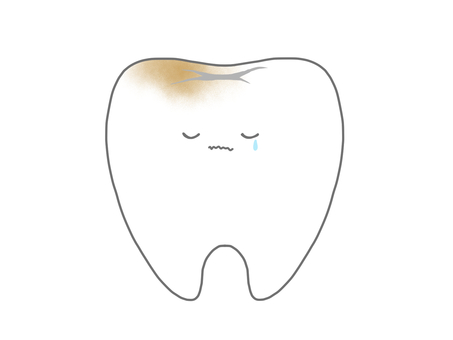 汚れが残って悲しむ歯 汚れが残って悲しむ歯 歯,臼歯,虫歯,歯みがき,永久歯,乳歯,奥歯,磨き残し,汚れ,歯医者のイラスト素材