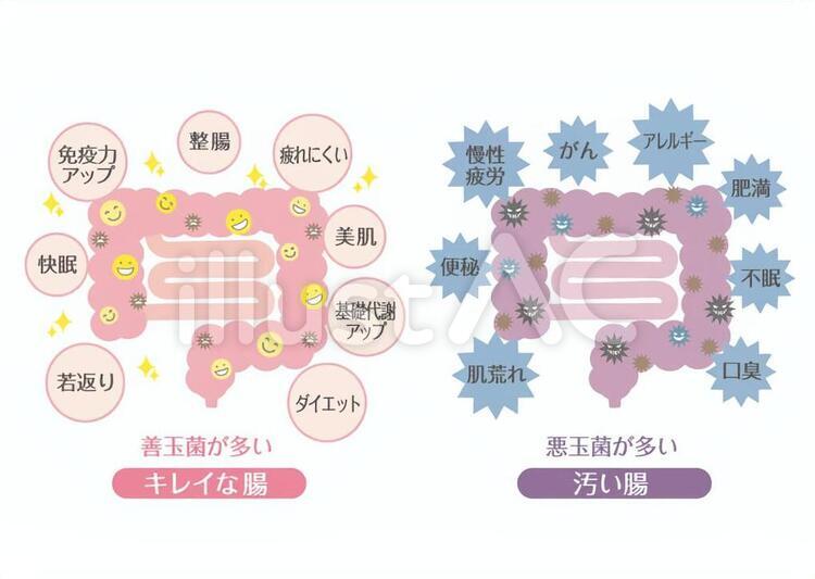 キレイな腸と汚い腸イラスト No 無料イラストなら イラストac