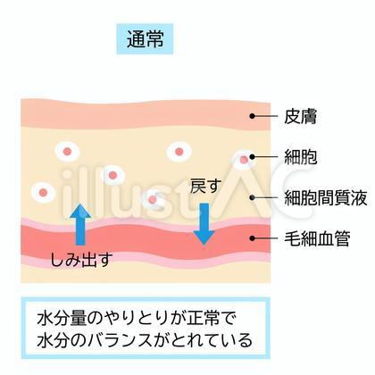 水分のバランスのとれた通常の肌断面図