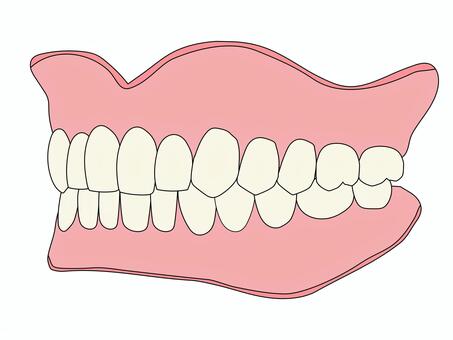 総義歯 斜め45度イラスト（主線あり） フルデンチャー,総義歯,入れ歯,上顎義歯,下顎義歯,歯科技工,歯科技工士,歯科,医療,教材用イラストのイラスト素材