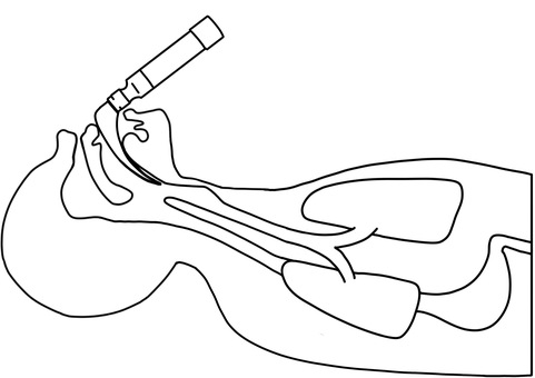 喉頭鏡を使用　線画 喉頭鏡,気管,断面,肺,挿管,線画のイラスト素材