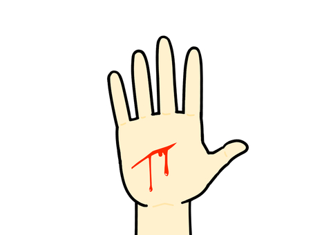 右手4 右手,手,人体,広げる,手のひら,傷,傷口,流血,血,怪我のイラスト素材